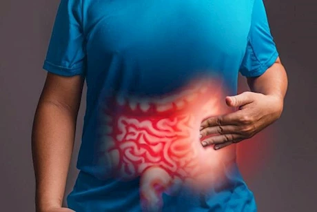احذر منها- دليلك للأطعمة المهيجة للقولون وكيفية استبدالها